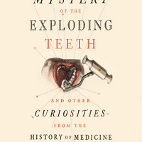 The Mystery of the Exploding Teeth