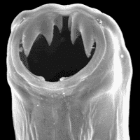 Ancylostoma Duodenale