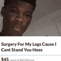 Surgery For My Legs Cause I Can't Stand You H*es
