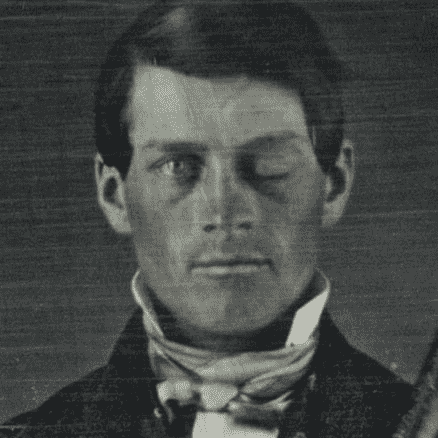 Phineas Gage (Post Accident)
