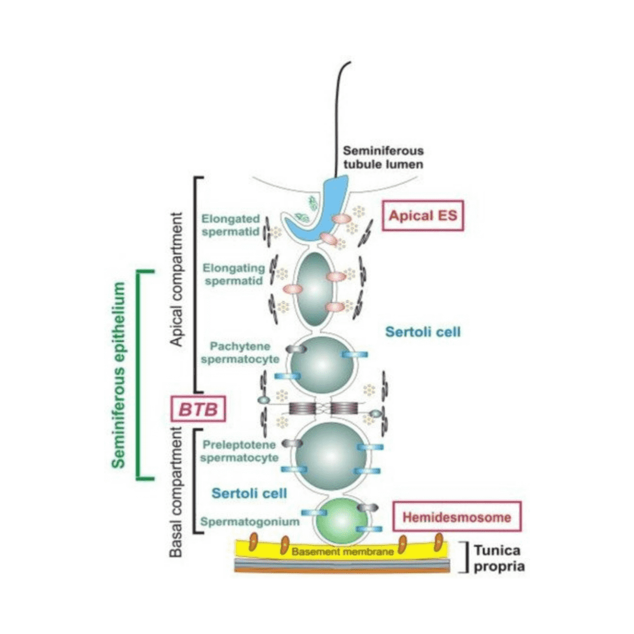 Pathophysiology