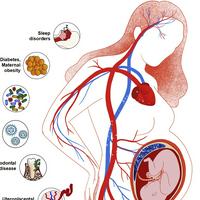 Etiology