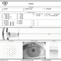 Biometry