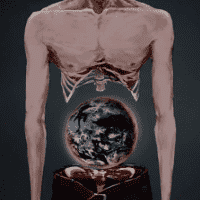 SCP-007 "Abdominal Planet"